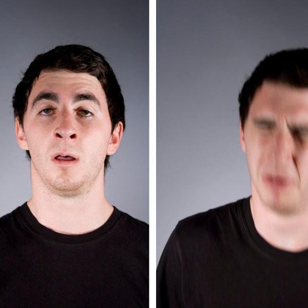 Funny sneezing fit from seasonal pollen allergies