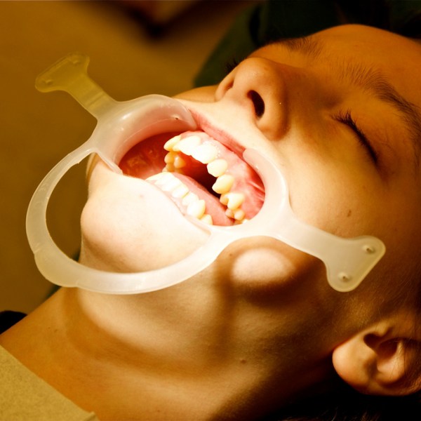 funny-dentist-braces-picture