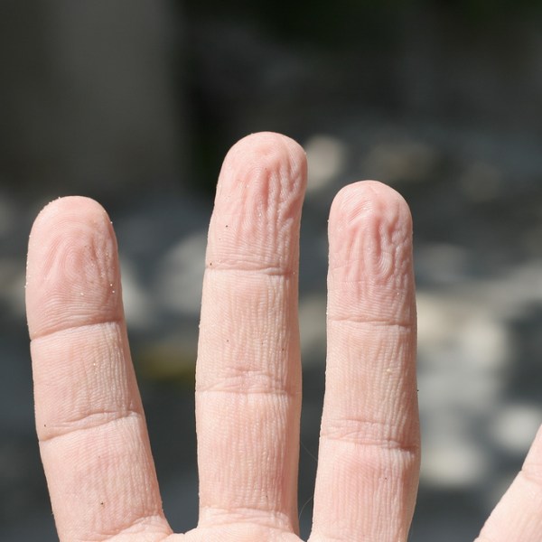 pruned-wrinkled-pruney-fingers-hand-gross