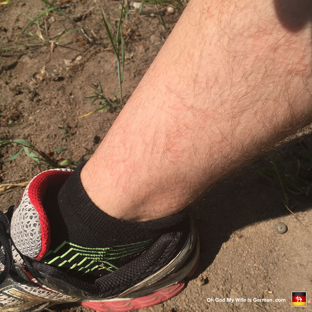 Stinging Nettle Rash - Swelling, Redness, Bumps, Progression